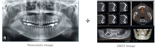 Dental 3D Cone Beam Images 