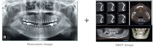 Dental-3D-Cone-Beam-images Dental 3D Cone Beam Images
